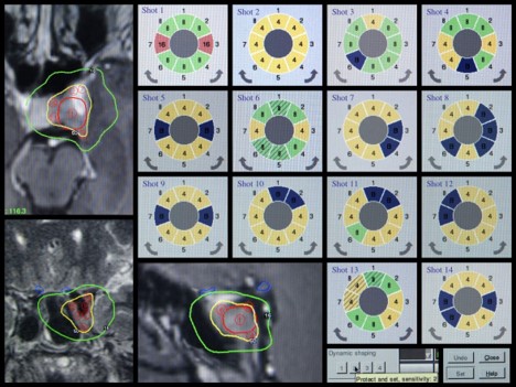 Gamma Knife treatment planning with sector optimization